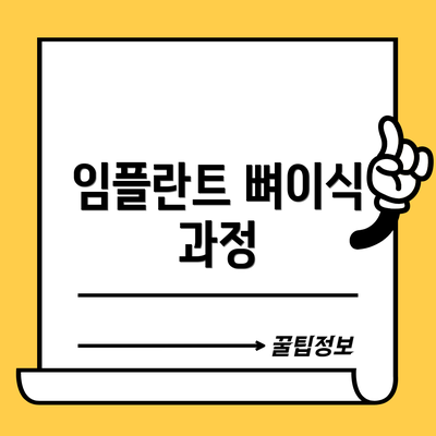 임플란트 뼈이식 과정